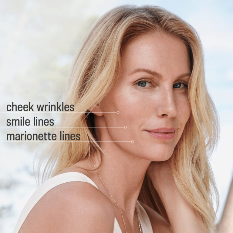 Sculptra Collagen Stimulator in Bowling Green, KY Near Me